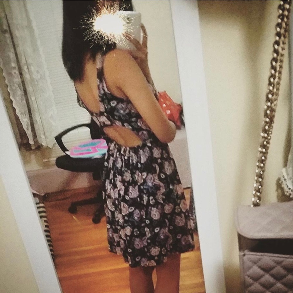 Abercrombie & Fitch Open Back Skater Dress